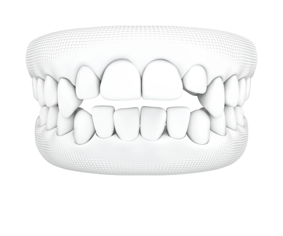 Orthodontics Near Houston